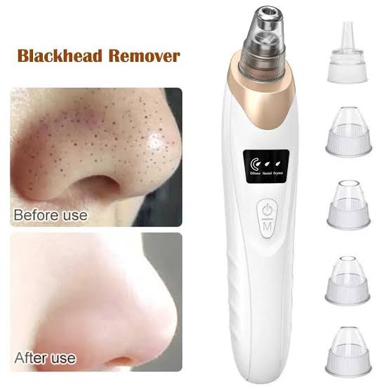 5 In 1 Blackhead Remover